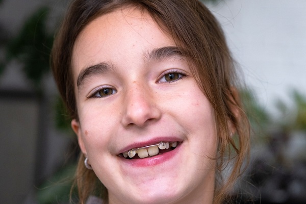 The Goal Of Early Othodontic Treatment