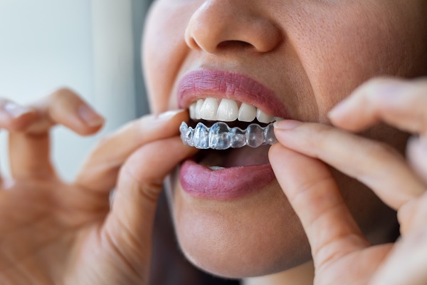 Questions To Ask Your Orthodontist About Invisalign